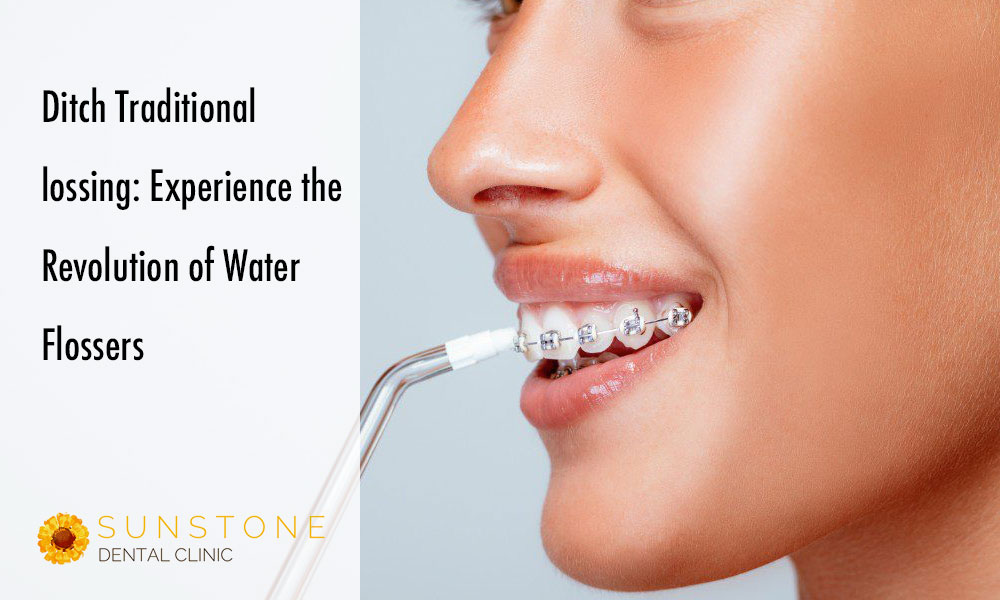 sunstone blog water flossers