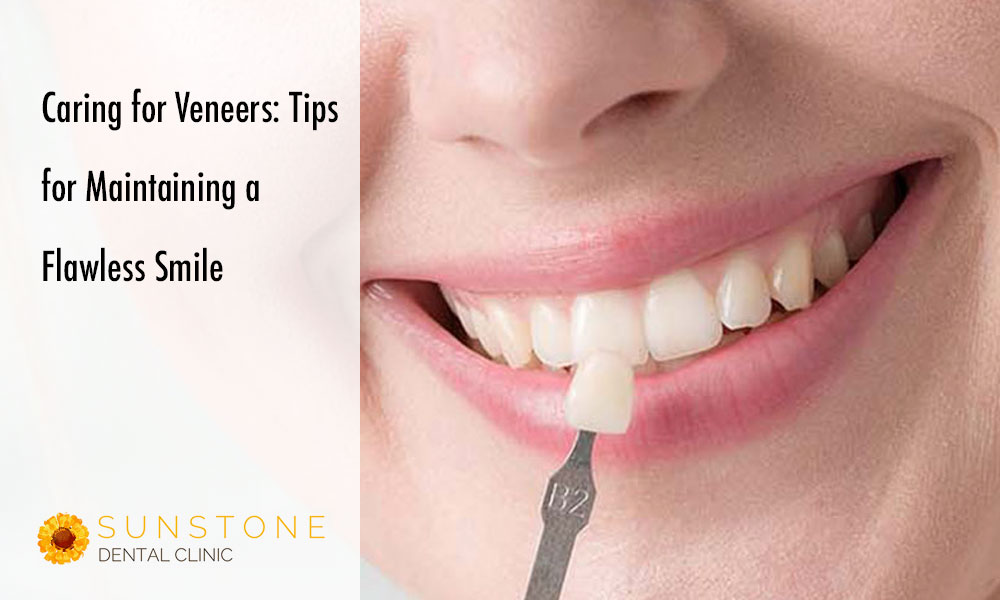 sunstone blog veneers